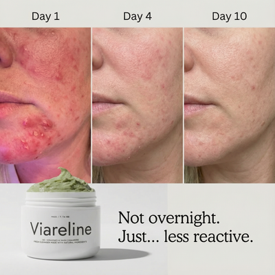Gentle Cleanser for Damaged Skin Barrier & Sensitive Skin - Barrier Balance™