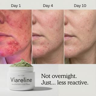 Gentle Cleanser for Damaged Skin Barrier & Sensitive Skin - Barrier Balance™
